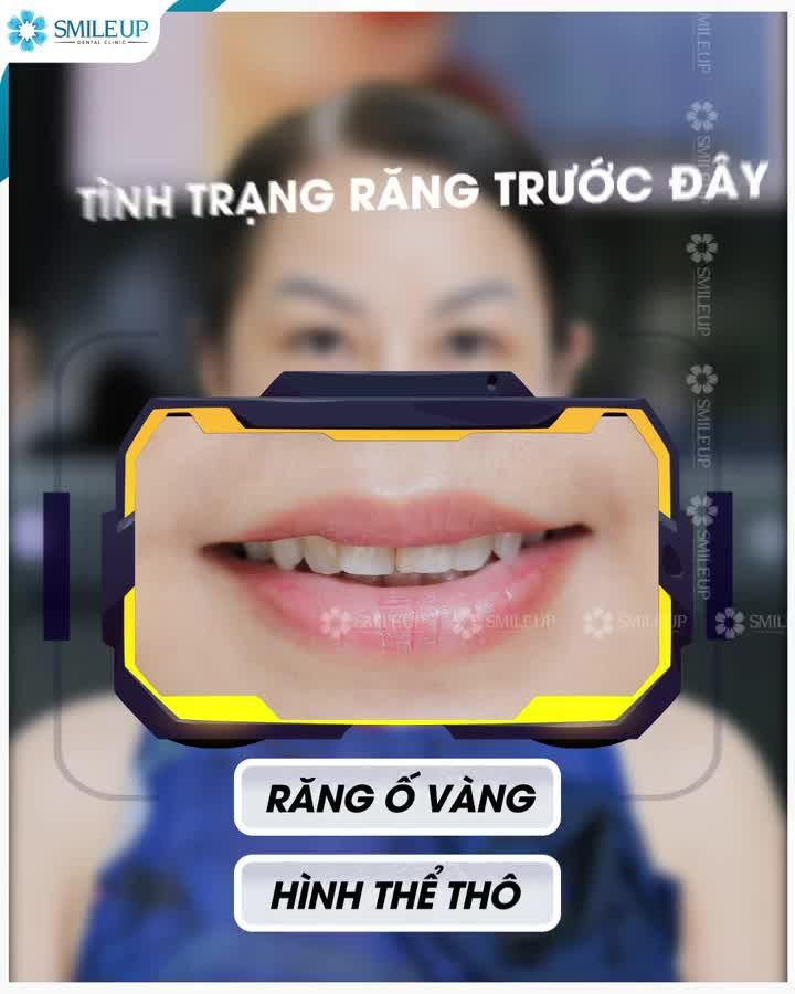 THAY ĐỔI  KIẾN TẠO “NỤ CƯỜI MỚI” CÙNG SMILE UP