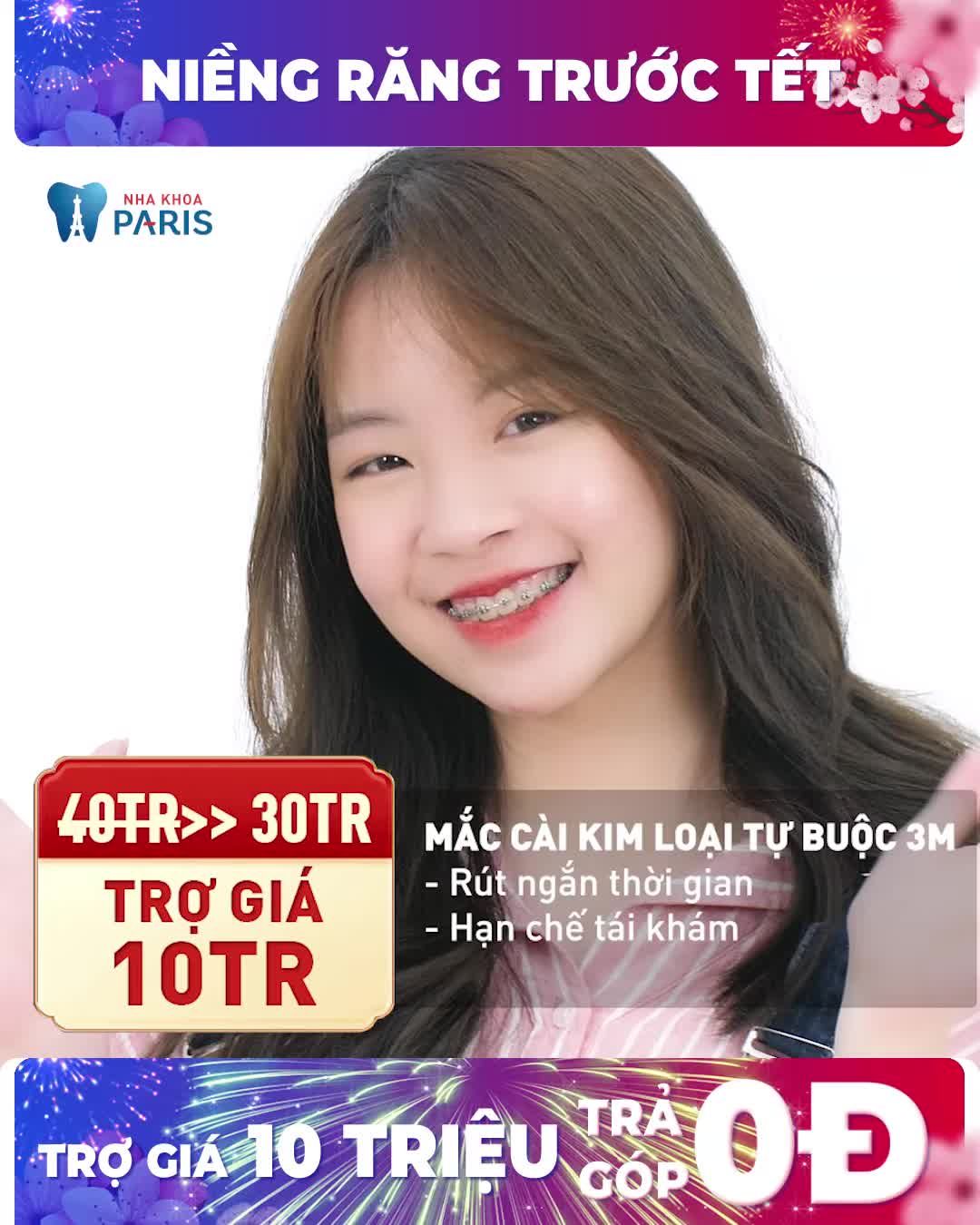 CUỐI NĂM DEAL SỐC NIỀNG RĂNG