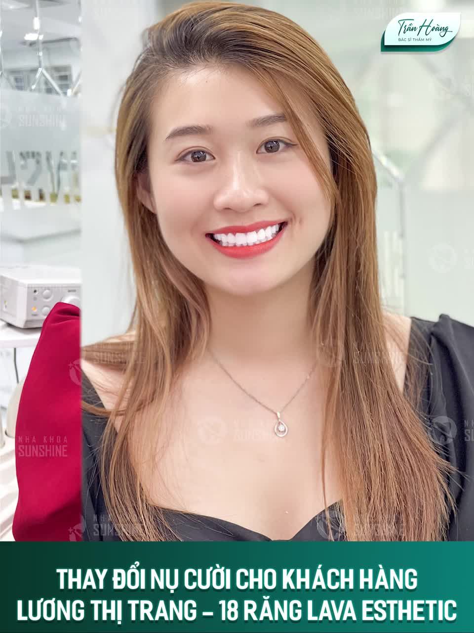 RĂNG ĐẸP CƯỜI SANG - TỰ TIN TOẢ SÁNG