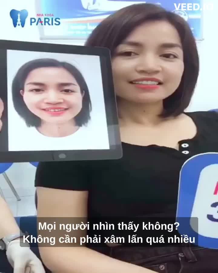 Bọc sứ cho Răng Ố Màu đón Tết
