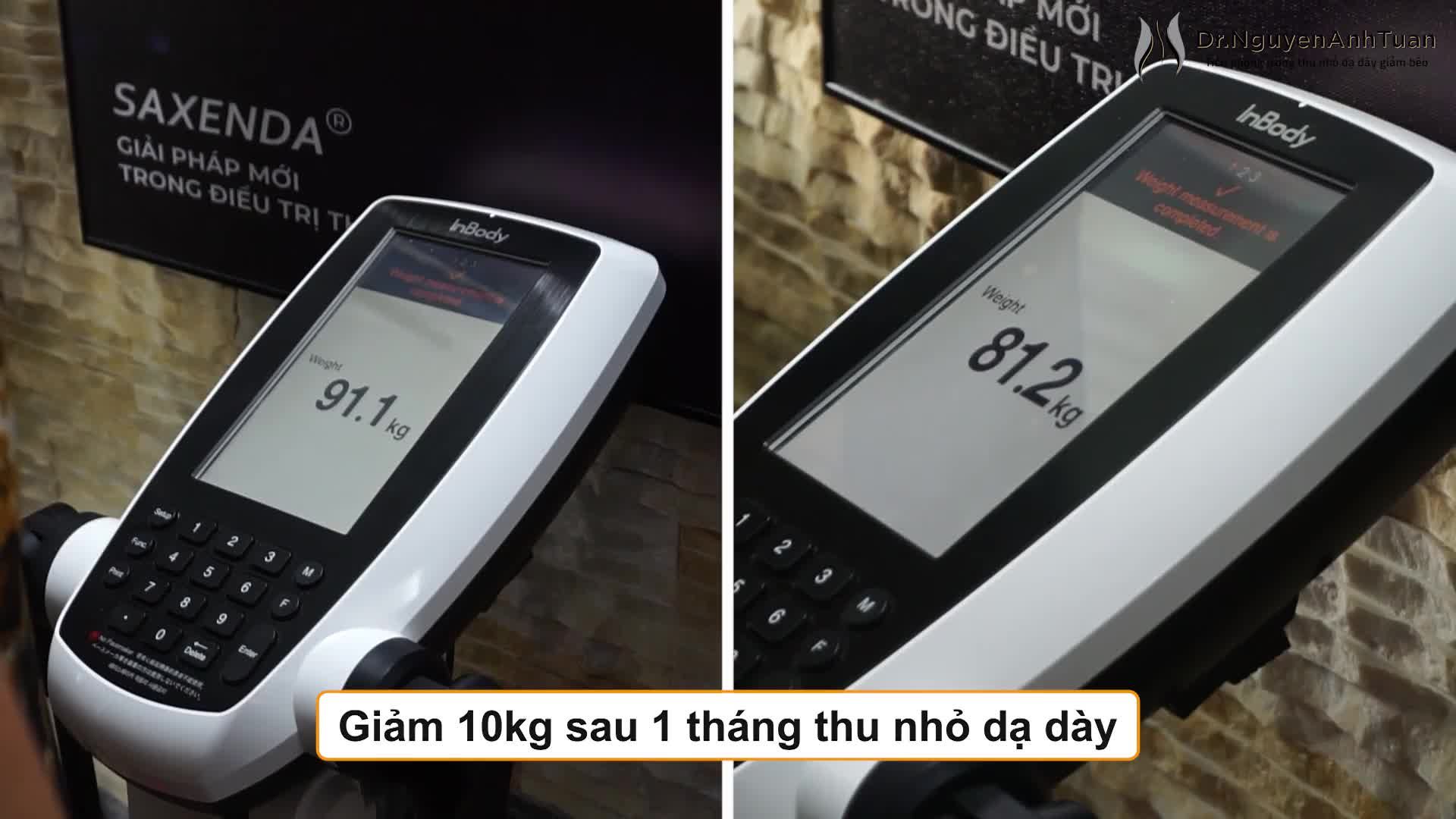 Chỉ sau 1 tháng thu nhỏ dạ dày giảm béo, bệnh nhân đã cảm nhận được hiệu quả của phương pháp khi giảm được chục kilogam, không còn bị đau đầu và thèm ăn như trước.