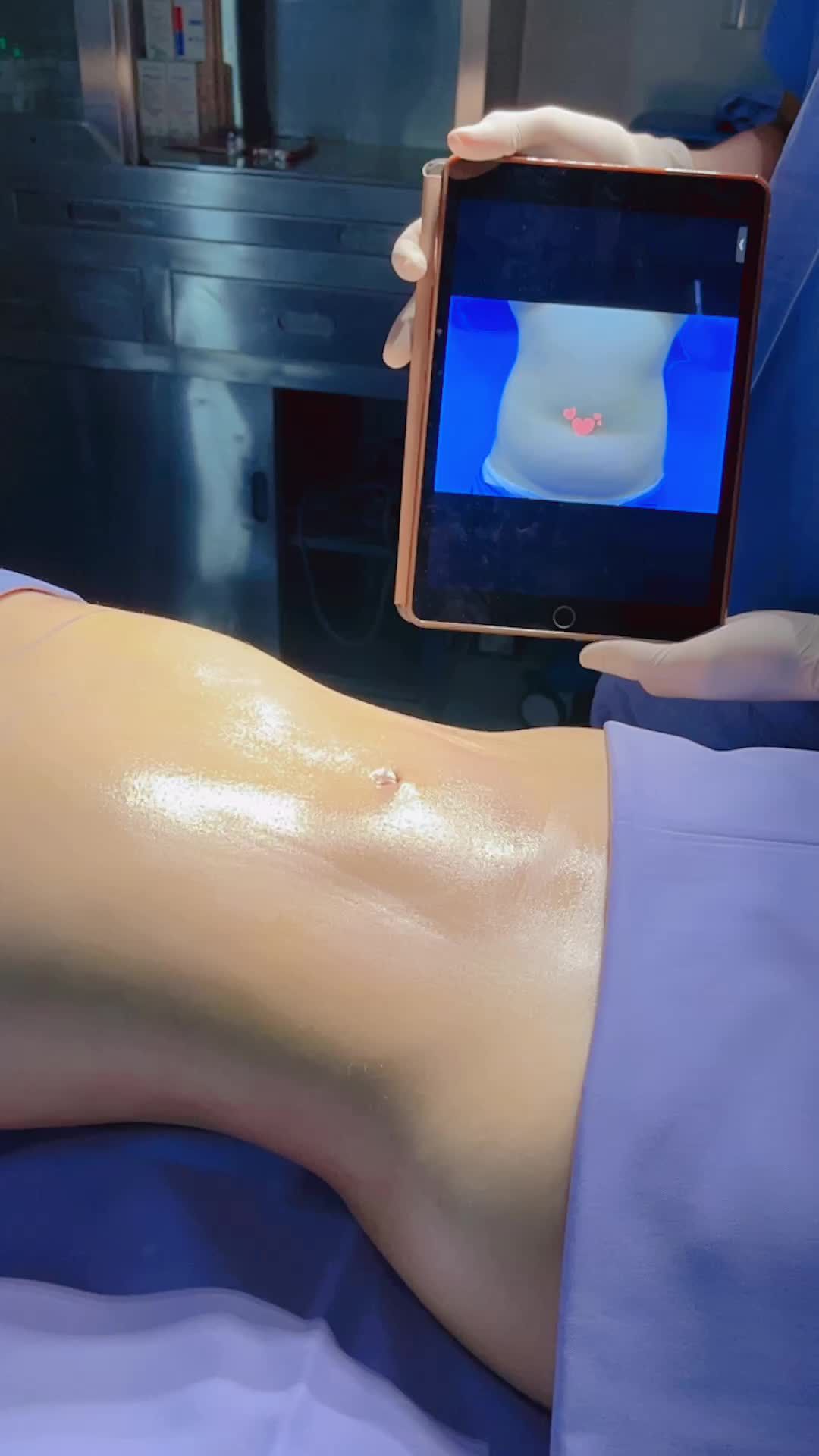 Giảm mỡ bây giờ có KỊP TẾT không? Có nhé các khách hàng thân yêu nhà Kangnam ơi!