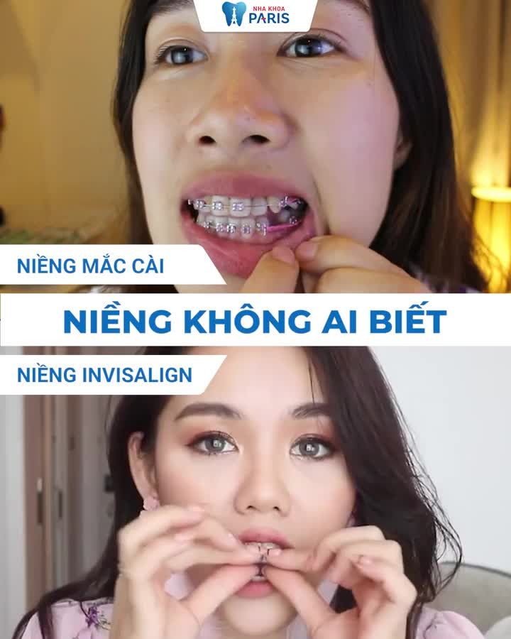 Vô hình- Tháo niềng dễ dàng- Ăn Tết trọn vị