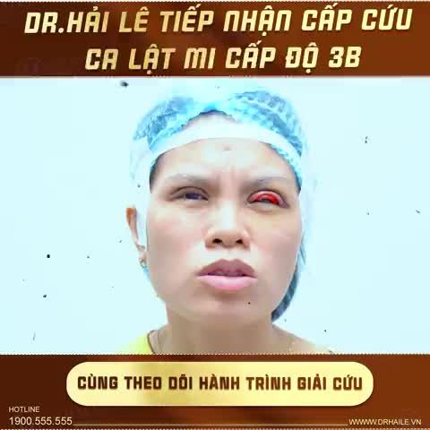 Với những ca mí lật khó thực hiện như trường hợp của vị khách hàng này, Dr.Hải Lê đã làm thế nào để giúp đôi mắt trở lại với vẻ đẹp tự nhiên?