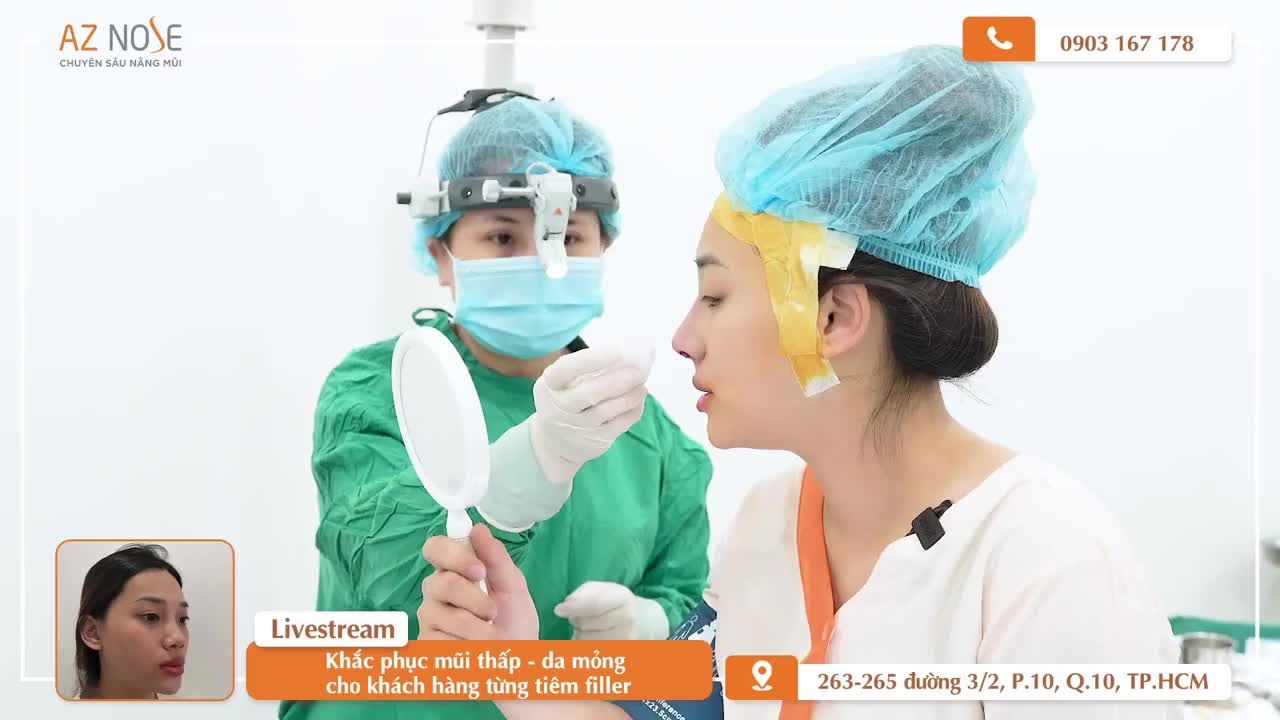 Dáng mũi Sline cao của cô nàng 2K3 đến từ Tây Ninh