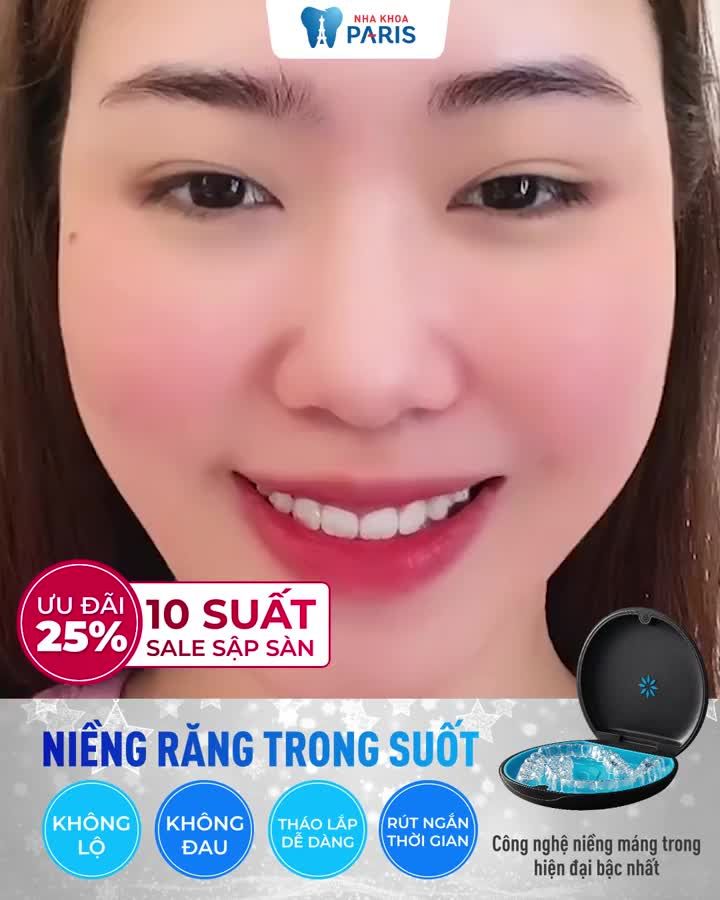 Chớp ngay xu hướng niềng răng cuối năm