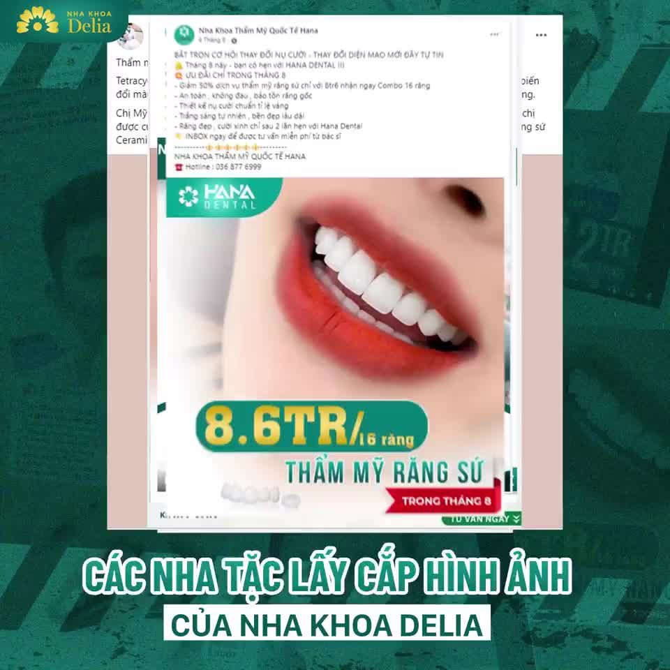 Kiều bào về nước làm răng sứ nên tìm hiểu kỹ và chọn những nha khoa uy tín, có bảo hành và 100% bác sĩ thực hiện.