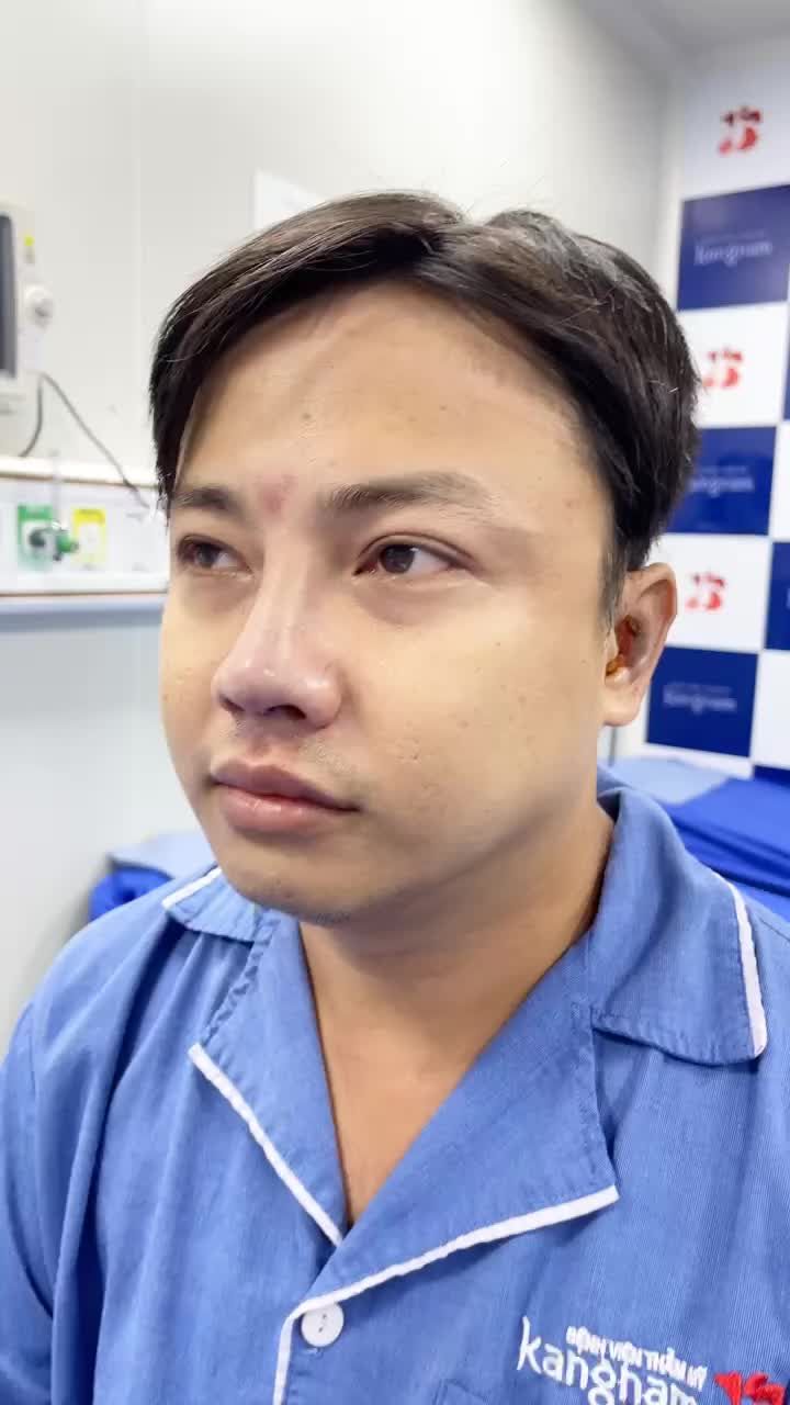 "Anh ưng haha" ngắn gọn 2 từ thôi ạ! Cận cảnh mũi vừa nâng xong của anh KH tại Sài Gòn