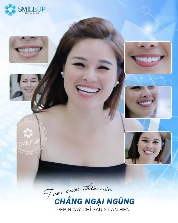RĂNG THAY ÁO MỚI – TRẮNG SÁNG TINH TẾ