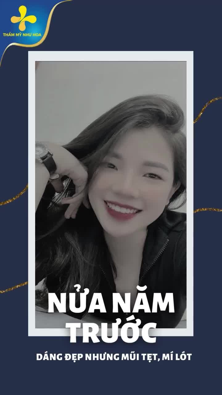 Combo giải quyết khuyết điểm mũi thấp, đầu mũi to tròn, mắt một mí cho bạn gái 2003.