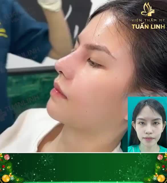 Cần gì app chỉnh ảnh, tự tin bắt trọn camera thường cùng chiếc mũi siêu xinh này nhé.