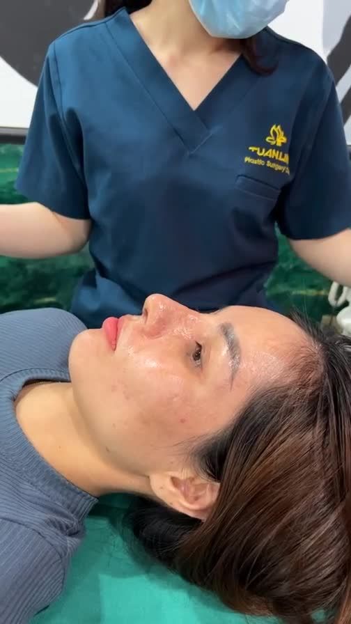 Case cấu trúc sửa lại vừa hoàn thành