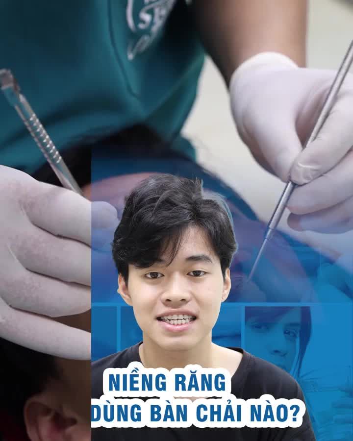 Niềng răng nên dùng bàn chải nào?