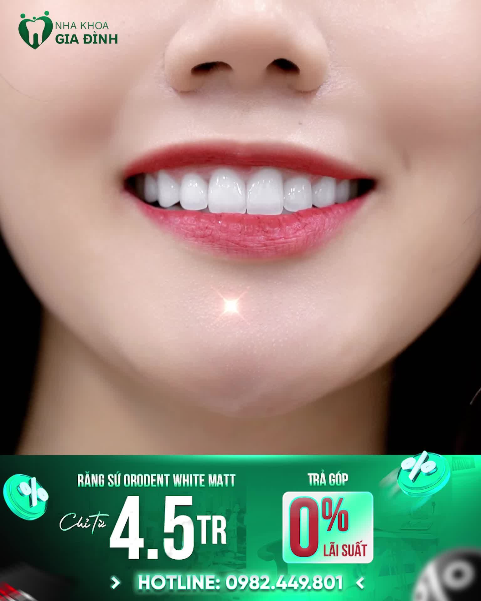 ORODENT - DÒNG SỨ ĐỈNH CAO TẠO NÊN ĐƯỜNG CƯỜI HOÀN MỸ