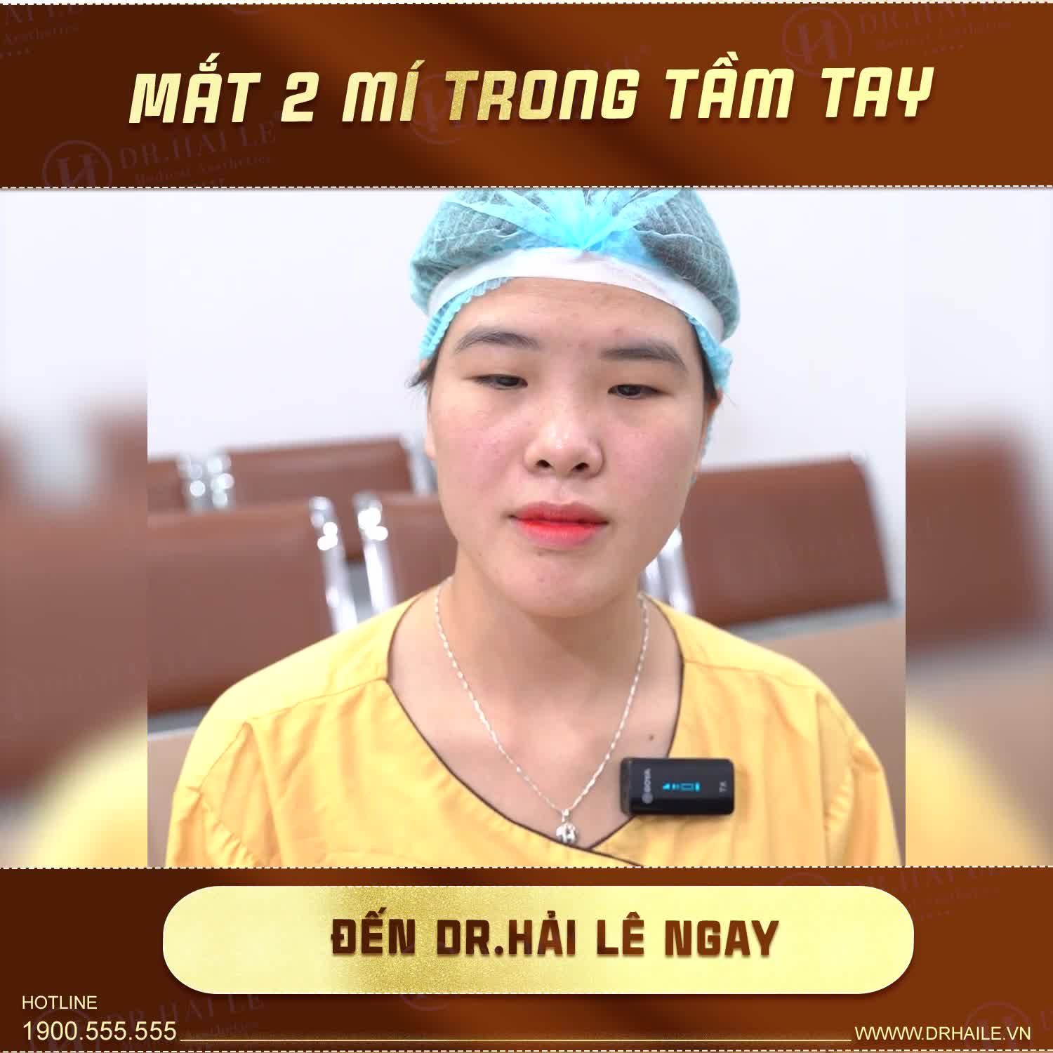 Vị khách hàng đến với Dr.Hải Lê với mong muốn “biến hóa” đôi mắt 1 mí của mình thành mắt 2 mí đẹp tự nhiên
