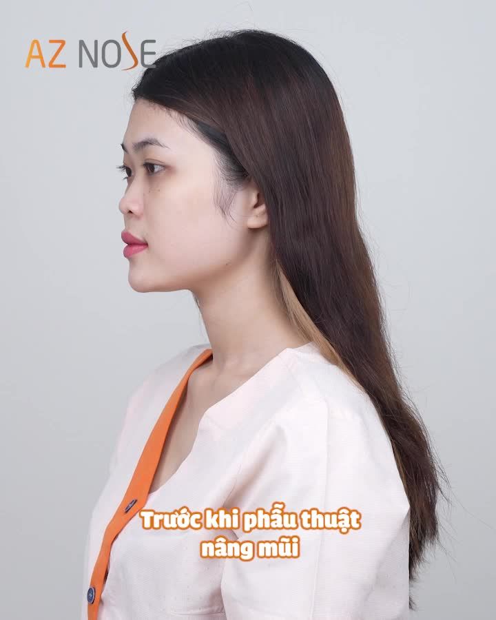 BẠN SẼ BẤT NGỜ VỚI SỰ THAY ĐỔI CỦA CÔ ẤY!