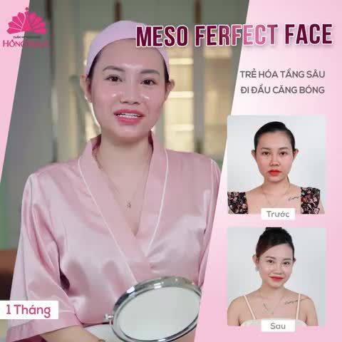 NHAN SẮC ĐẸP VƯỢT THỜI GIAN CỦA KH U30 SAU KHI THỰC HIỆN MESO