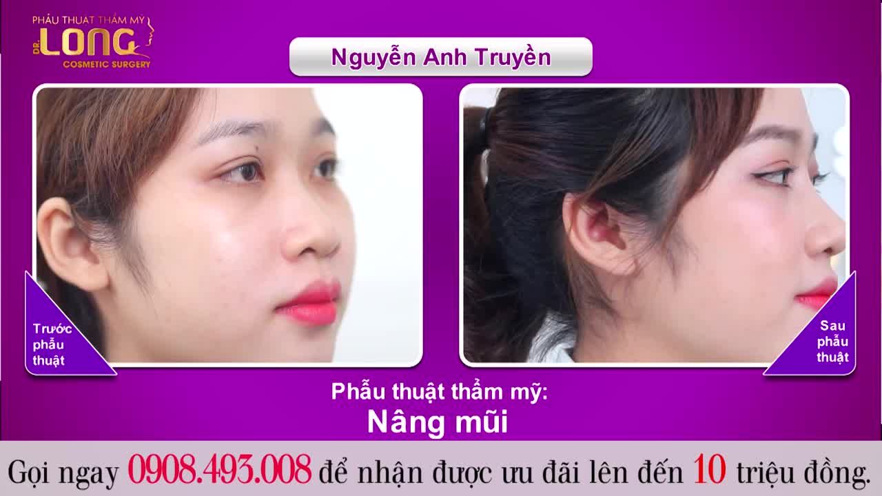 CÔ GÁI ĐẾN TỪ HẬU GIANG QUYẾT TÂM NÂNG MŨI TÌM CÔNG VIỆC MỚI