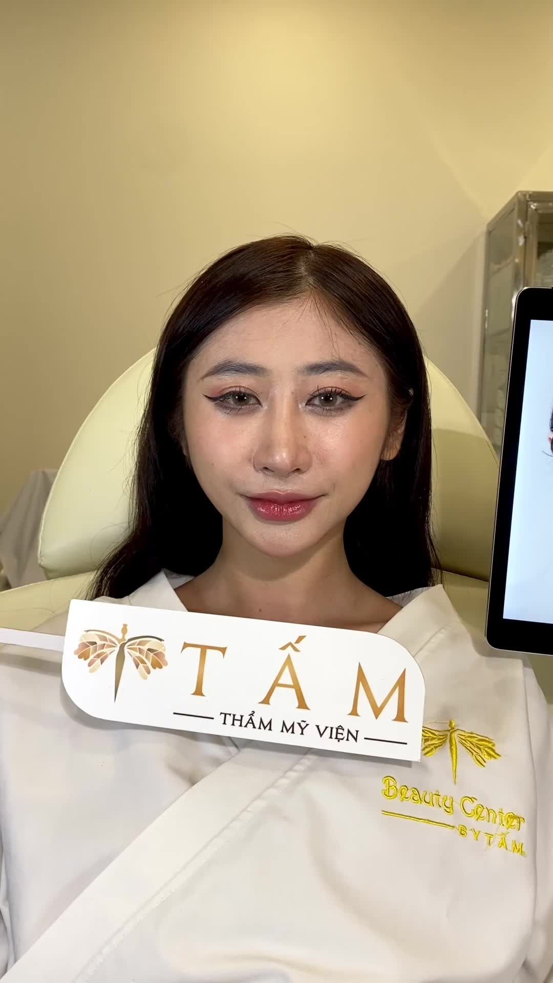 Chị khách quay lại tái khám sau 2 tháng sử dụng dịch vụ Vline Perfect tại Thẩm mỹ viện #Tấm.