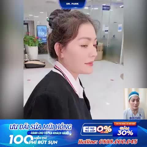 ĐỘ TUỔI NÀO THÌ PHÙ HỢP NÂNG MŨI?