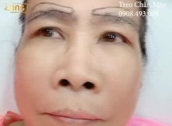 TREO CHÂN MÀY CẢI THIỆN KHUÔN MẶT NHƯ THẾ NÀO?