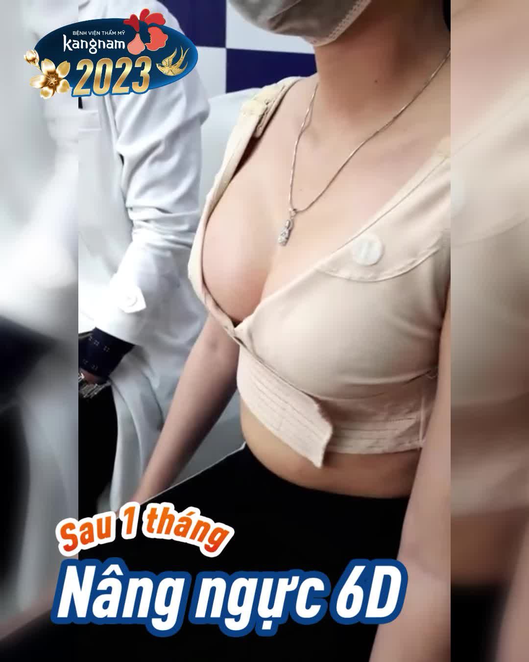 KH Việt Kiều Mỹ - Bọc răng sứ ĐẸP KỊP TẾT tại Kangnam Sài Gòn!