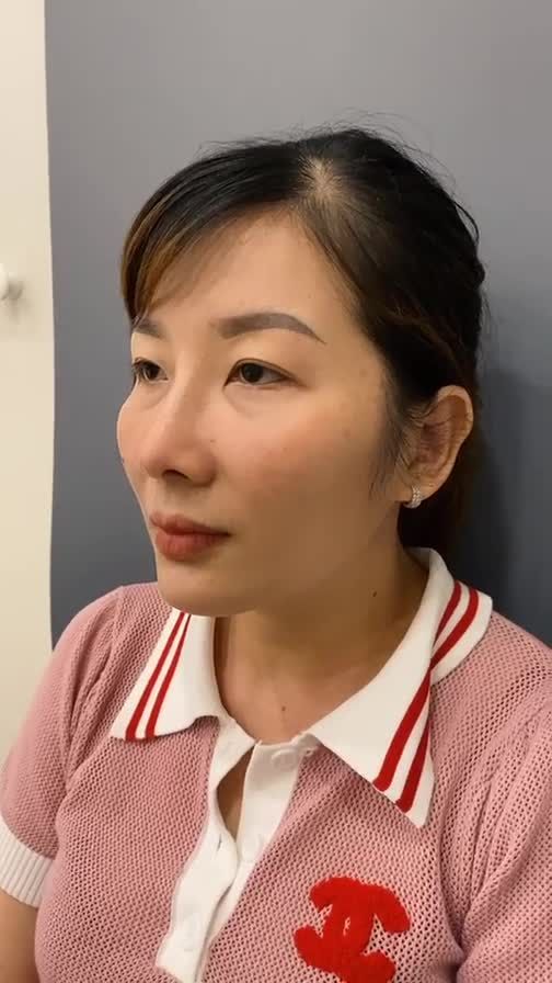 TẠO HÌNH DÁNG MŨI CAO TÂY PHONG THỦY TỰ NHIÊN CHO CHỊ KHÁCH HÀNG TỪ BÌNH DƯƠNG
