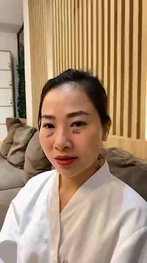 CA MÍ DƯỚI CHUẨN BỊ VÀO PHÒNG PHẪU THUẬT