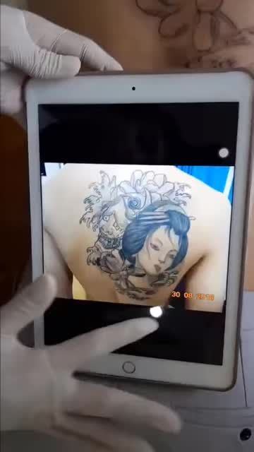 U là trời - Kết quả xóa xăm sau 2 lần đây rồi!!!!