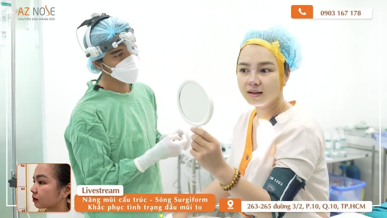 Cải thiện đầu mũi t.o với phương pháp nâng mũi cấu trúc