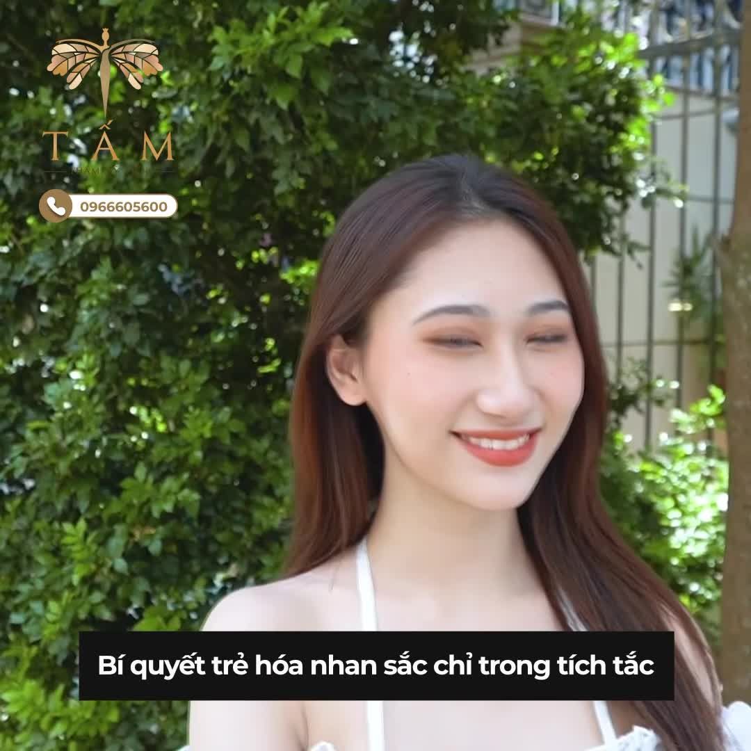 Nhan sắc xinh tươi chỉ sau 30p nhờ Combo filler thái dương - má siêu đỉnh
