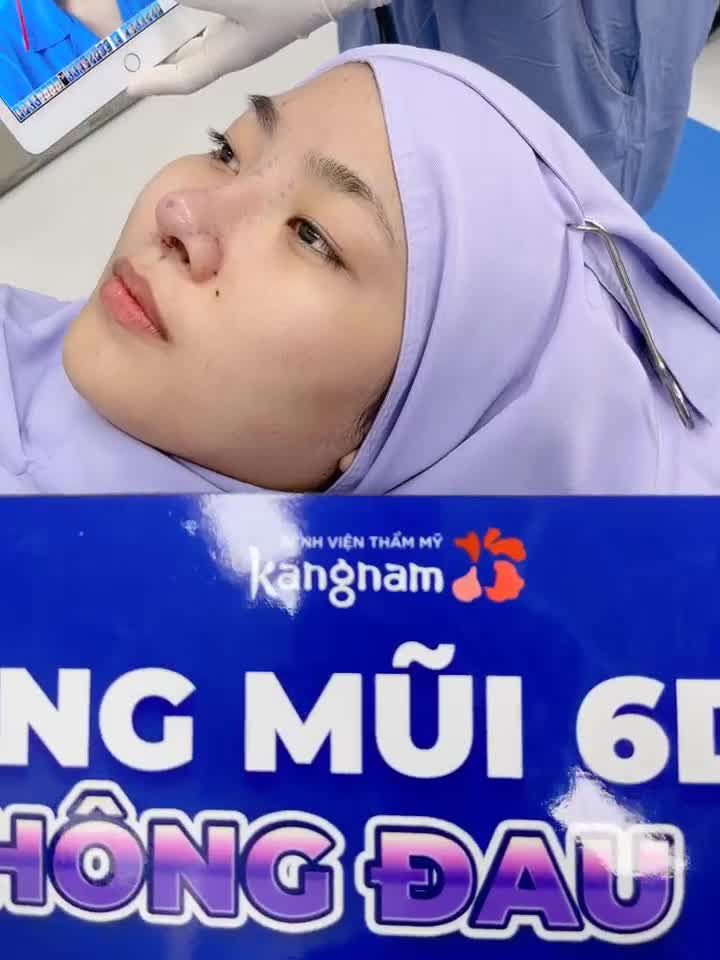 Siêu phẩm Nâng mũi 6D đón Tết Chị em ơi chốt đơn sớm nào! Chắc chắn đẹp trước Tết luôn nha!