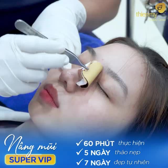 Phương pháp nâng mũi Super Vip giúp bạn chỉnh sửa dáng mũi tẹt, đầu mũi to, lệch hoặc bị hỏng do phẫu thuật nâng mũi/sau tai nạn.