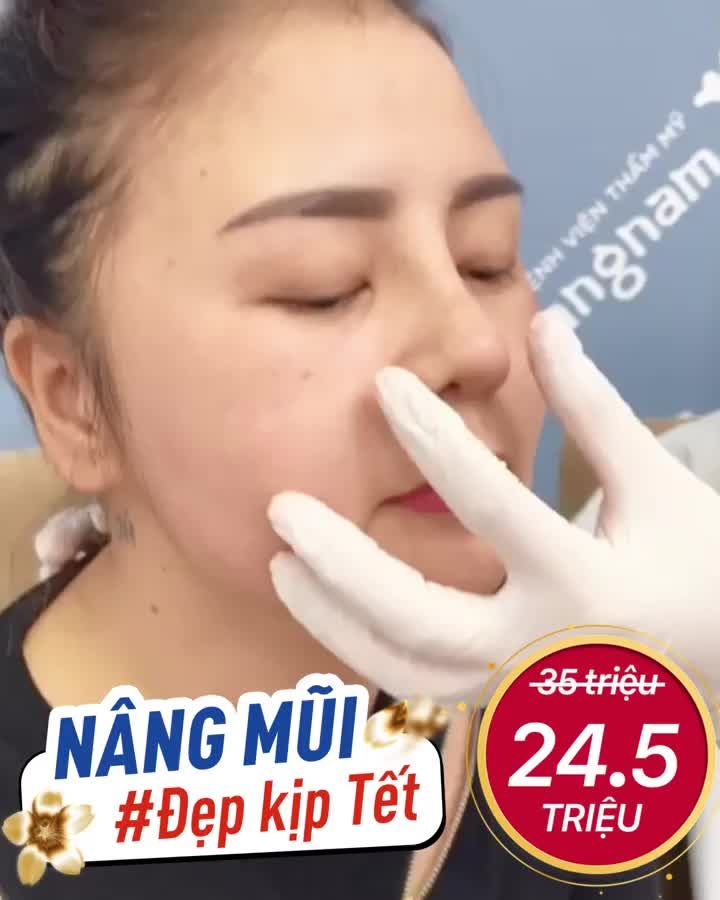 Hơn 1 tháng nữa là Tết! Nâng mũi thôi