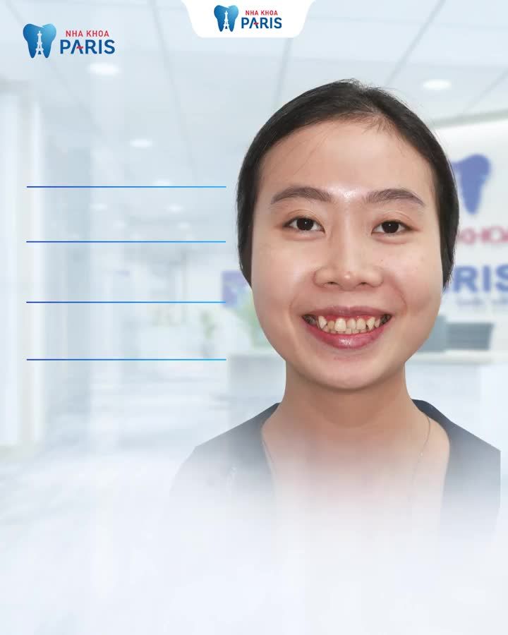 Niềng trong suốt cùng Tiến sĩ chuyên khoa