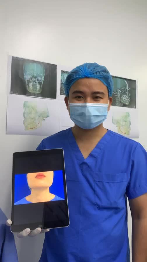 Hàm vuông khắc phục bằng cách nào?