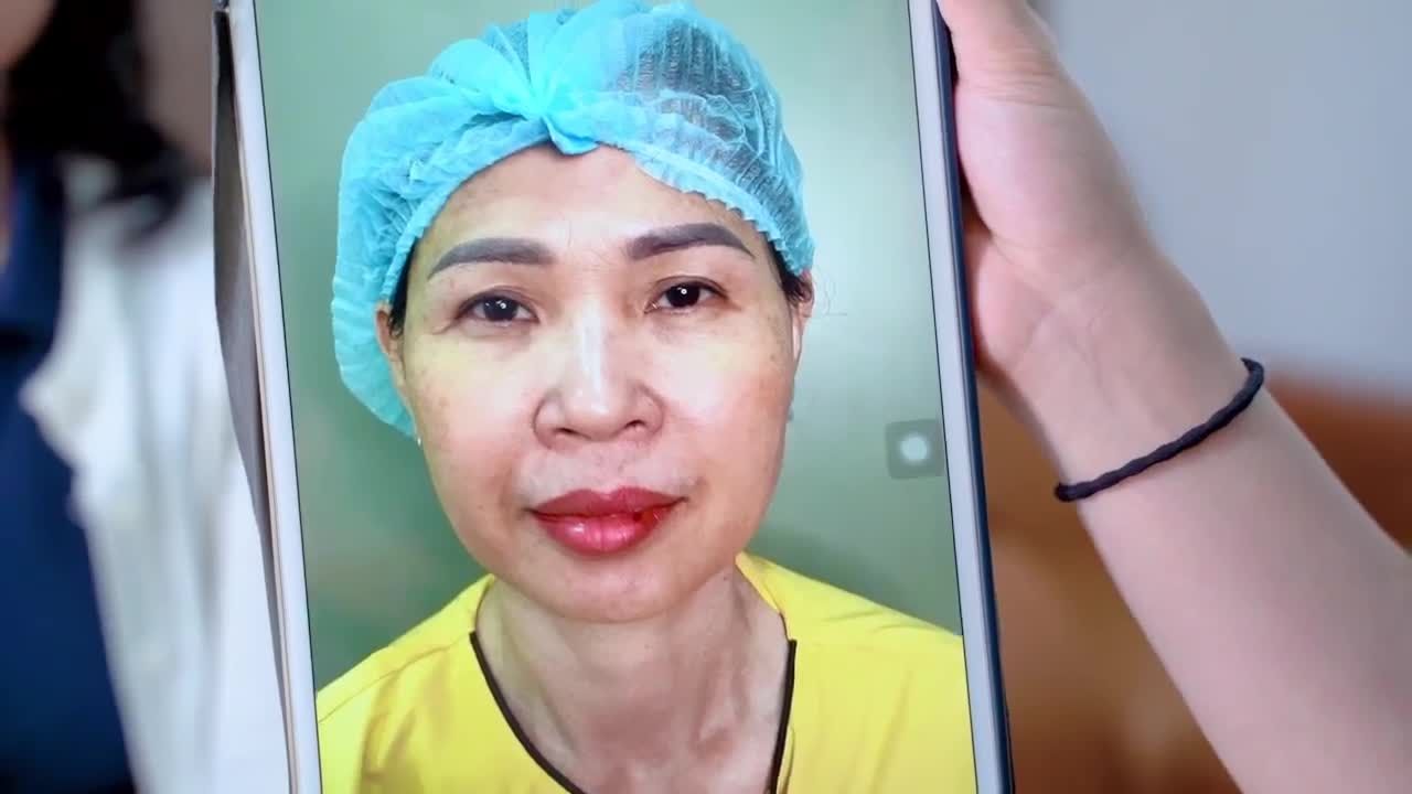 Một đôi mắt trẻ đẹp sẽ giúp bạn tự tin như thế nào? Theo dõi ngay