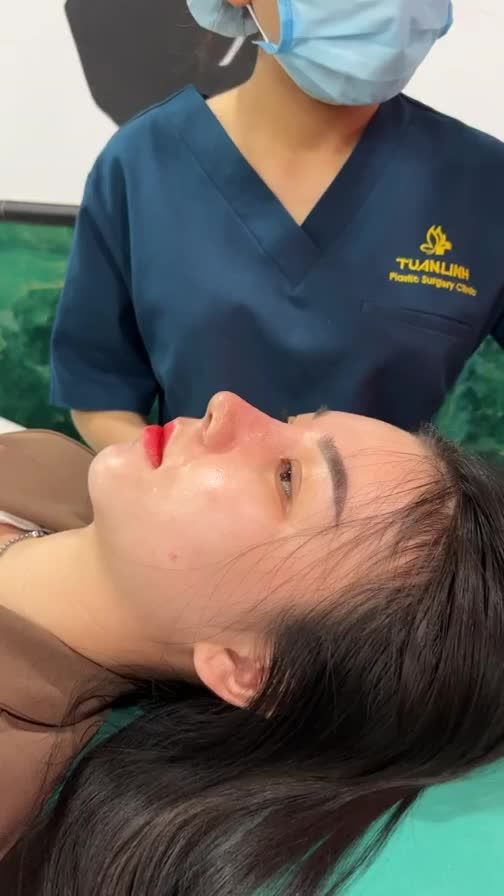 NÂNG MŨI BỌC SỤN GIÁ CHỈ 12TR - 10 NGÀY MŨI ĐẸP SIÊU TỰ