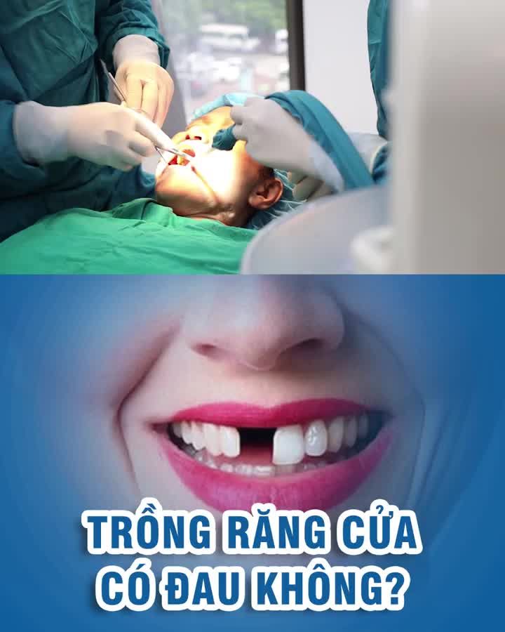 Trồng răng cửa có đau không?