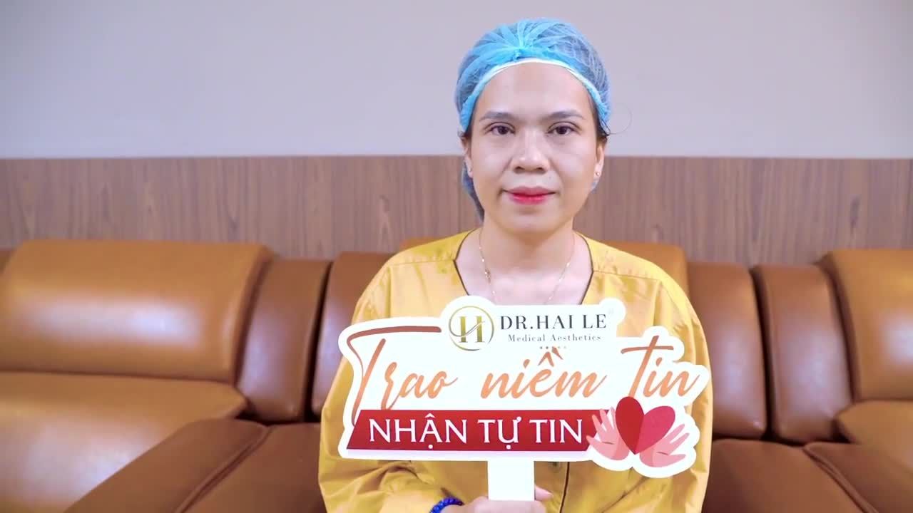Cắt mí có đau không? Cả nhà cùng theo dõi để có câu trả lời