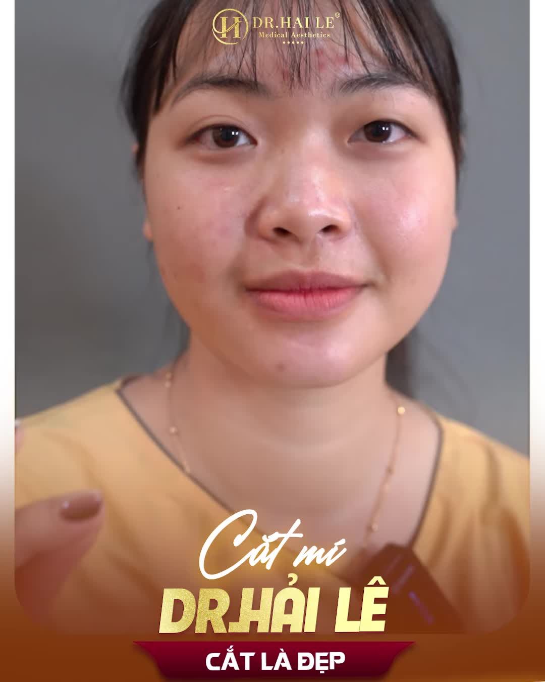 Đây có phải đôi mắt của 1 người không vậy cả nhà... Nhìn lạ lắm, nhận không ra