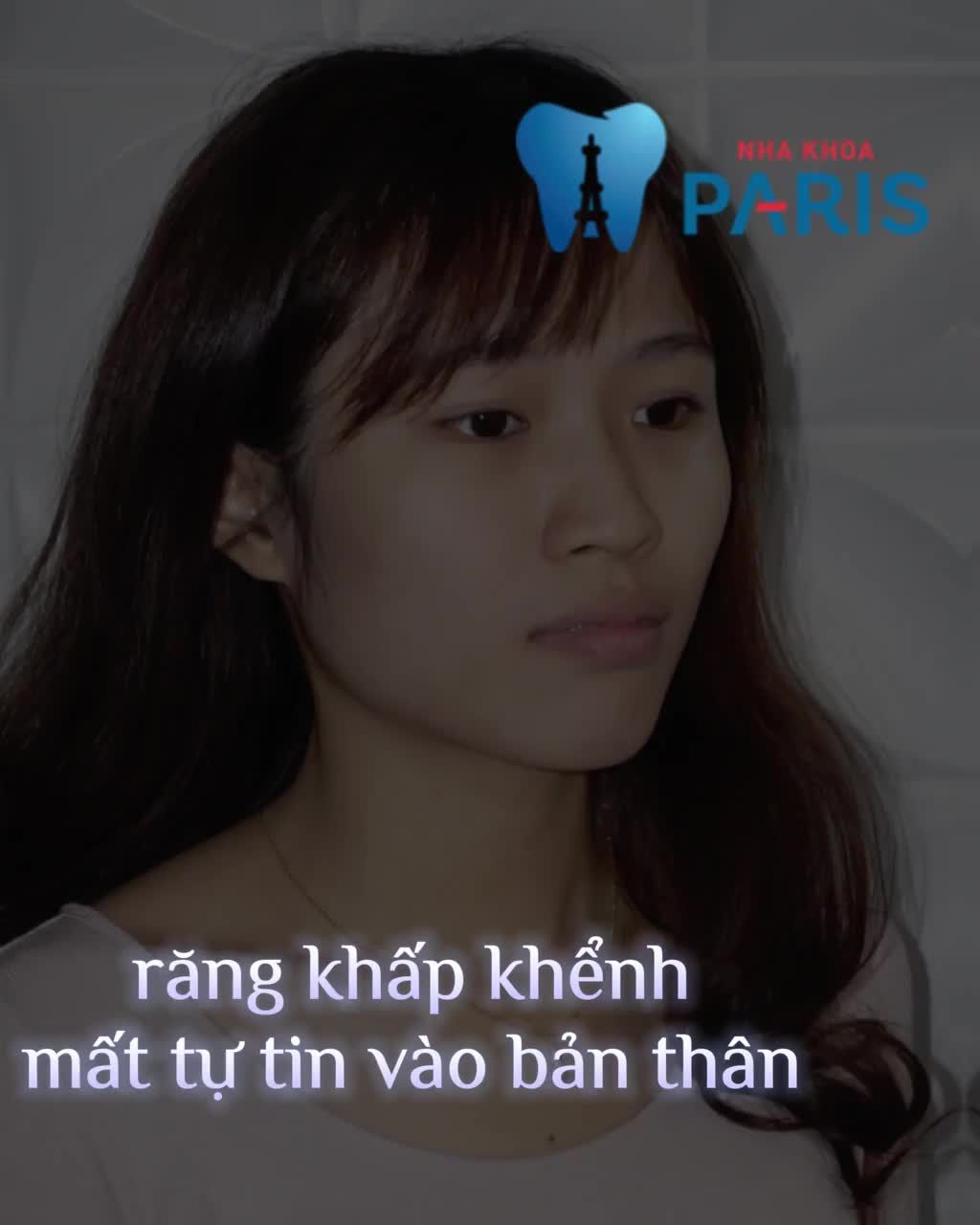 Tự tin với nụ cười đều đẹp, hoàn hảo