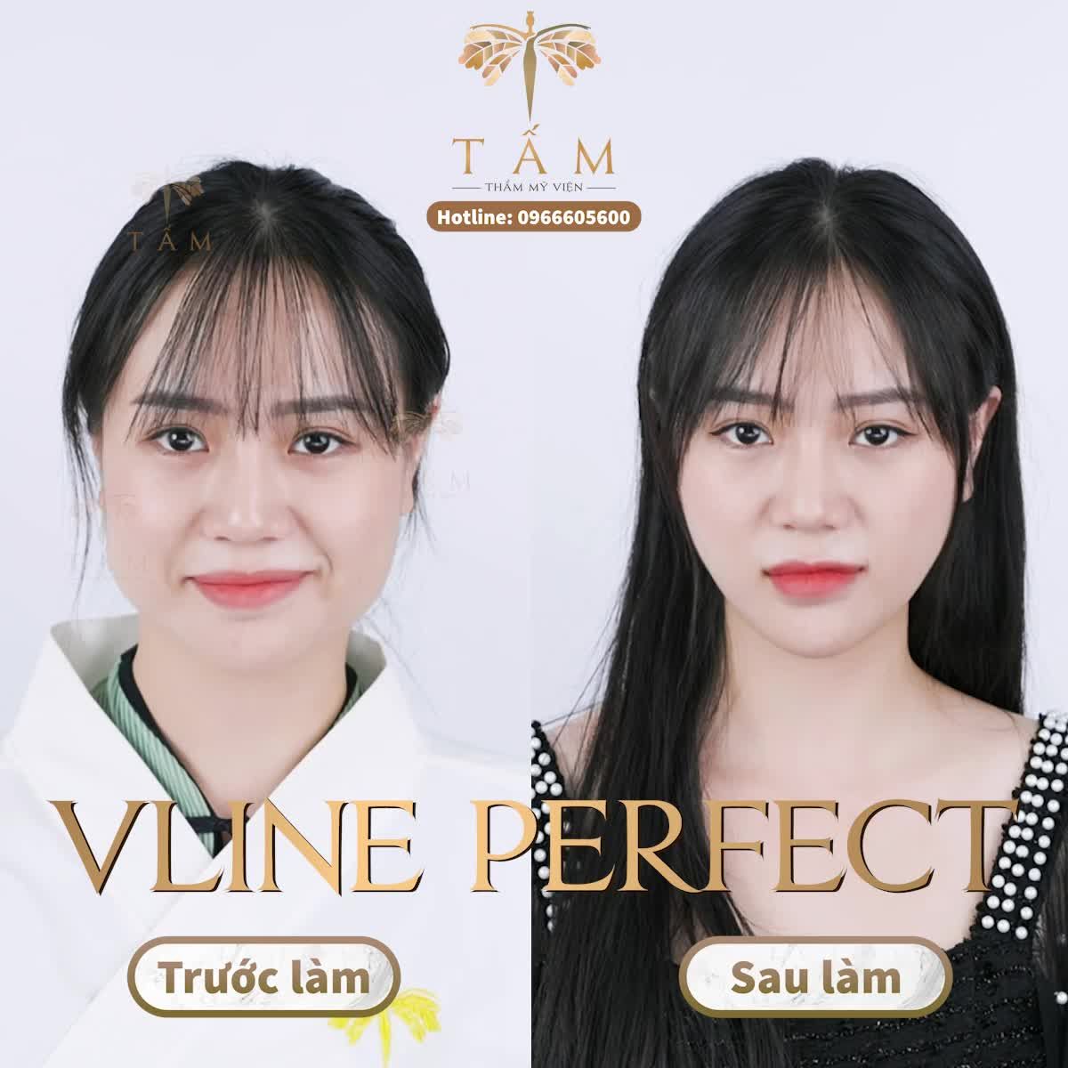 Hóa "thiên thần" với Vline Perfect