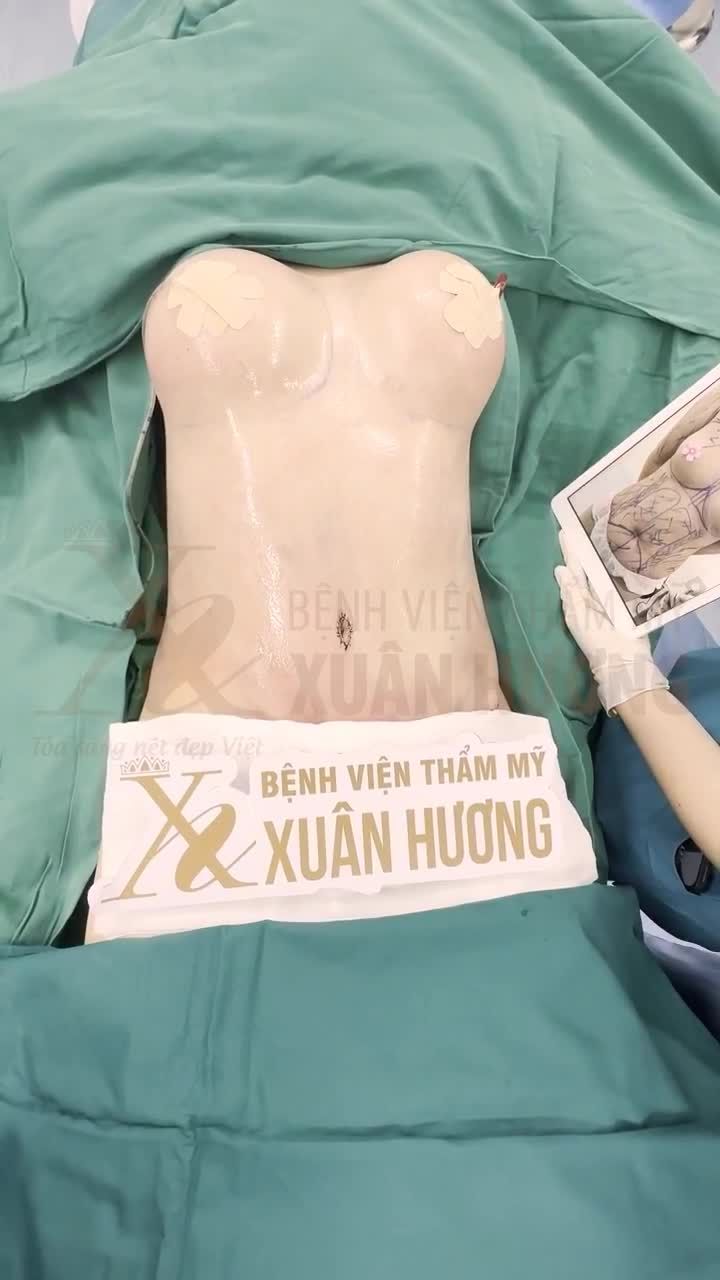 "ĐỘ" LẠI SỐ ĐO 3 VÒNG VỚI BỘ BA DỊCH VỤ THẦN THÁNH HÚT MỠ BỤNG - CHUYỂN RỐN - NÂNG VÒNG 1