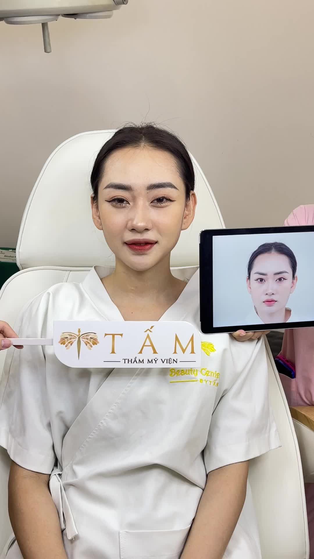 Chị khách quay lại tái khám sau 2 tháng sử dụng dịch vụ Vline Perfect tại Tấm.