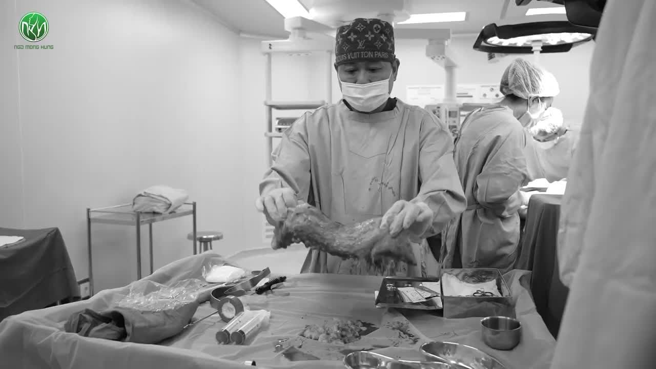 HÚT MỠ CĂNG DA BỤNG  - TRẢ LẠI VÒNG EO THON GỌN CHO NỮ KHÁCH HÀNG