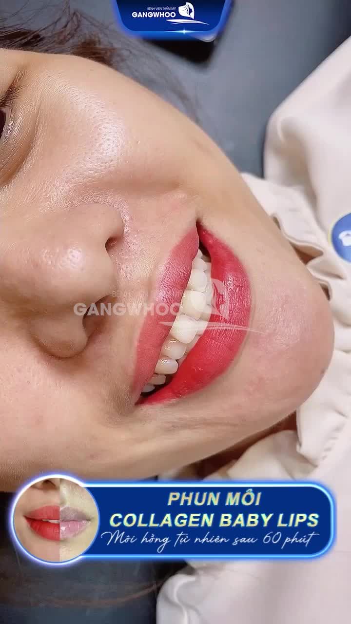 CHỈ 60 PHÚT MÔI HỒNG TỰ NHIÊN ĐÓN TẾT CỰC XINH CÙNG CÔNG NGHỆ COLLAGEN BABY LIPS