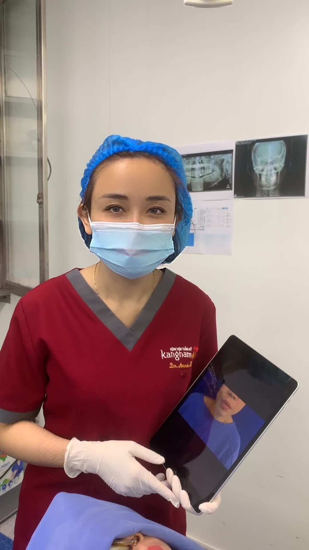 Bất ngờ kết quả phẫu thuật chỉnh hàm hô 2 hàm, trượt cằm tại bệnh viện thẩm mỹ KangNam sau 180 phút