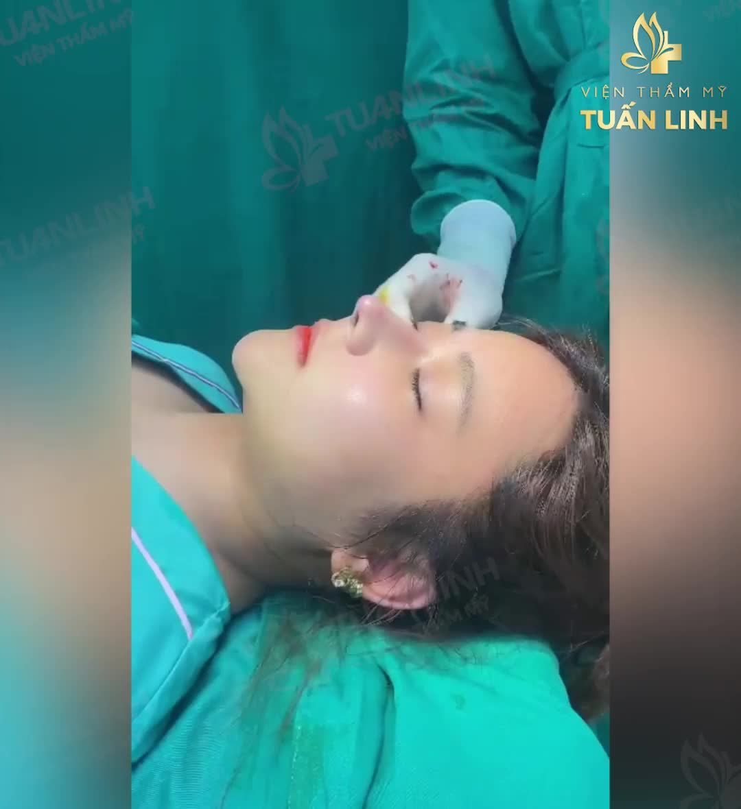 NÂNG MŨI TÀI LỘC ĐÓN TẾT - ƯU ĐÃI SIÊU HẤP DẪN.