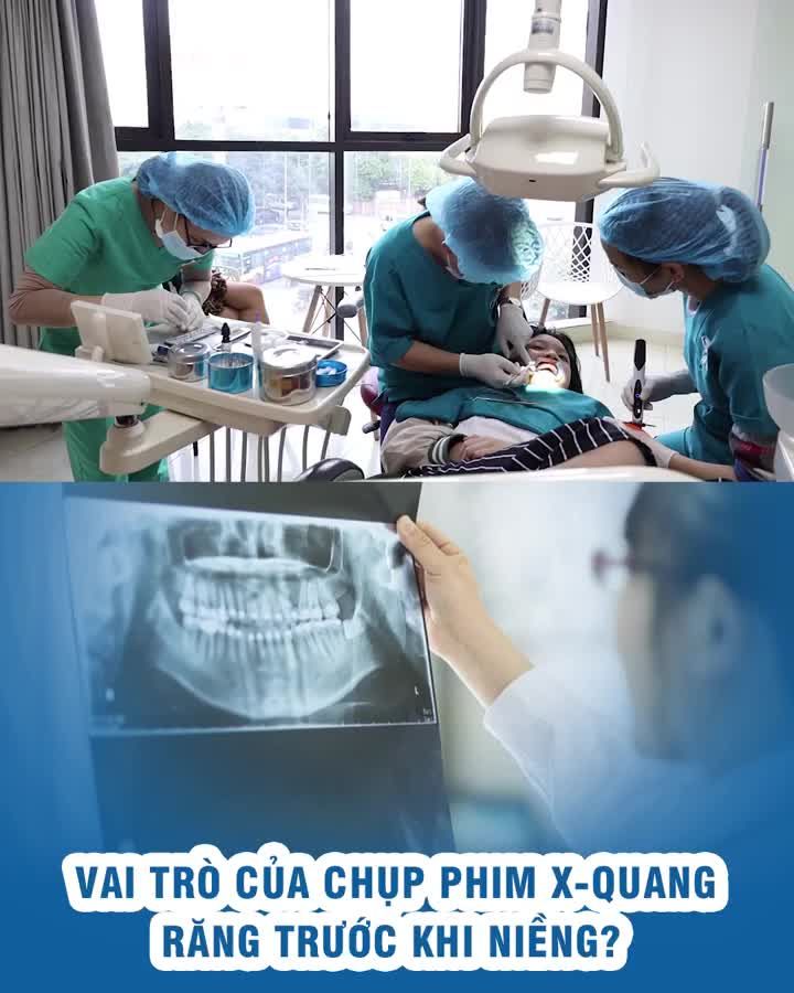 Vai trò của chụp phim X-quang răng trước khi niềng?